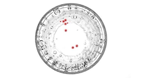 Se você tiver sintomas de prostatite, deverá fazer o teste para detectar infecções ocultas.
